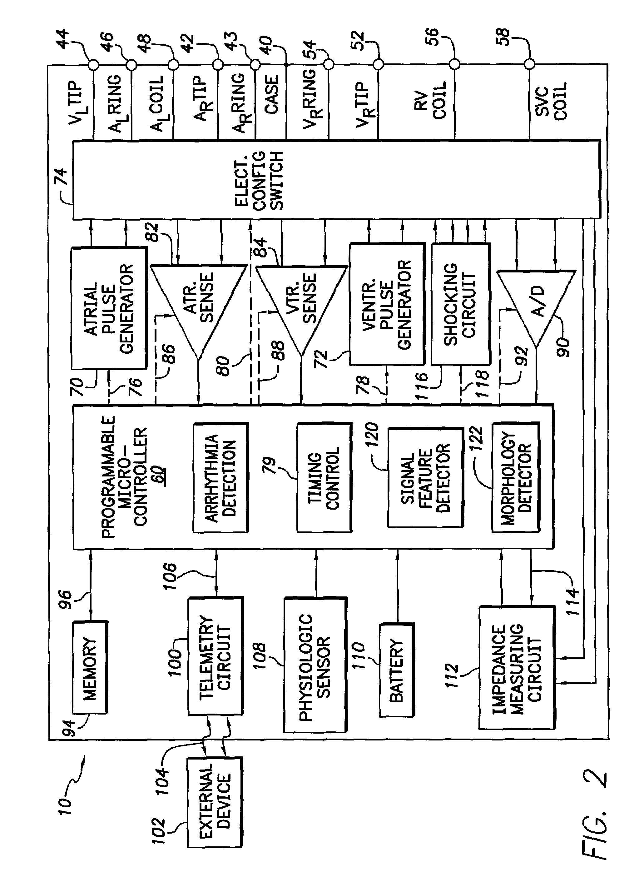 Method and device for enhanced capture tracking by discrimination of fusion beats