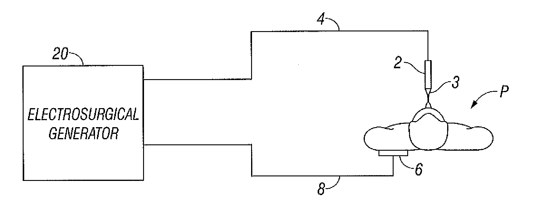 Electrosurgical Apparatus With High Speed Energy Recovery