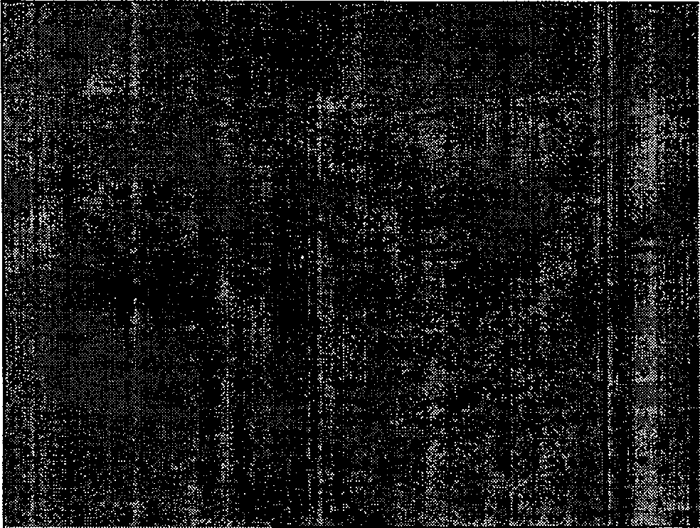 Amnion stroma tectorial blood vessel internal branch and preparing method thereof