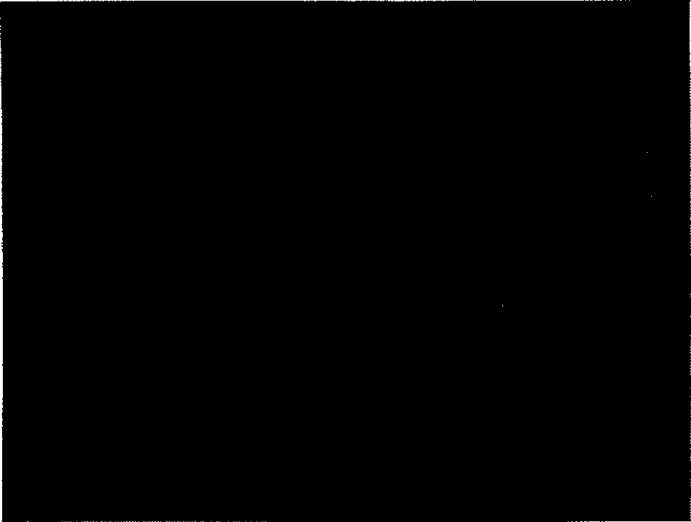 Amnion stroma tectorial blood vessel internal branch and preparing method thereof