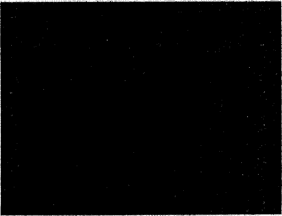 Amnion stroma tectorial blood vessel internal branch and preparing method thereof