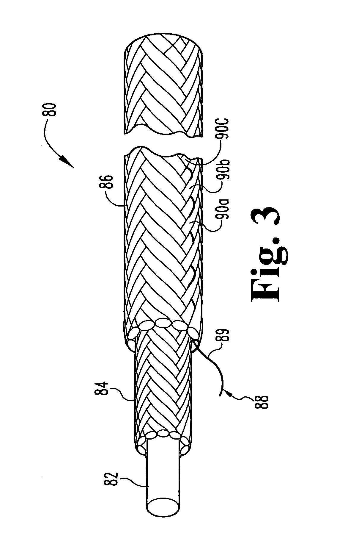 Radiopaque, coaxial orthopedic tether design and method