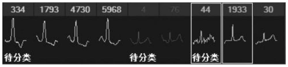 Electrocardiogram analysis method and electrocardiogram analysis device