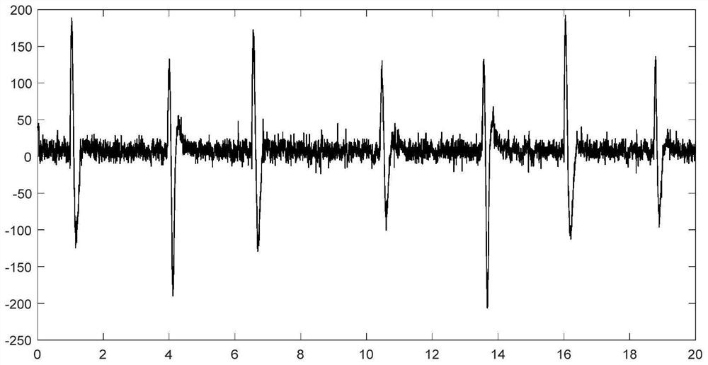 Blink and tooth biting judgment method and system based on electroencephalogram