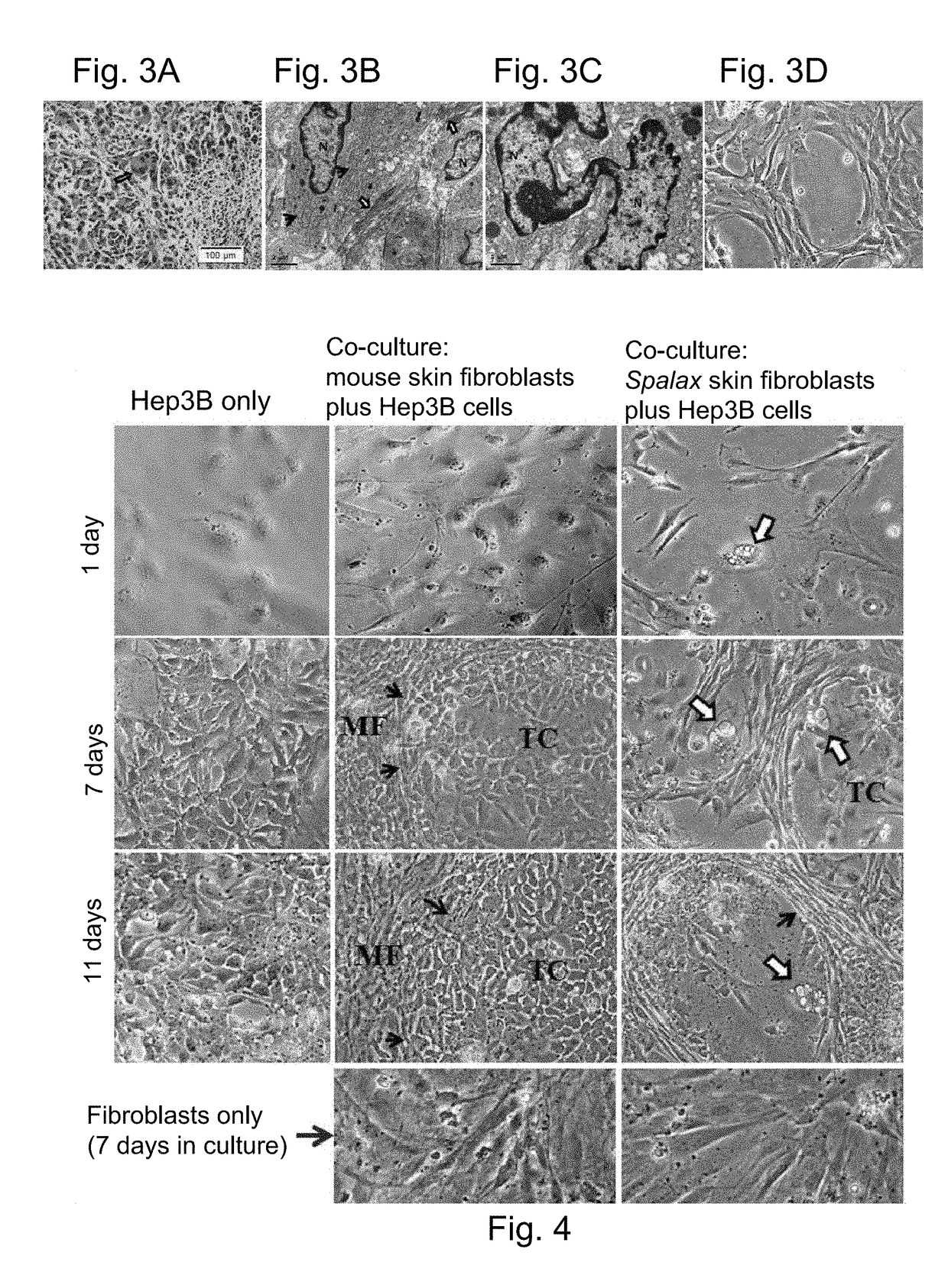 Spalax fibroblast-derived Anti-cancer agents