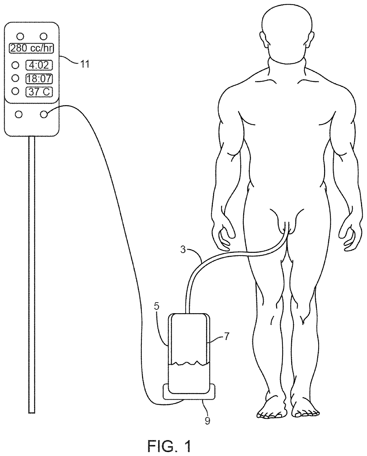 Systems, devices and methods for draining and analyzing bodily fluids