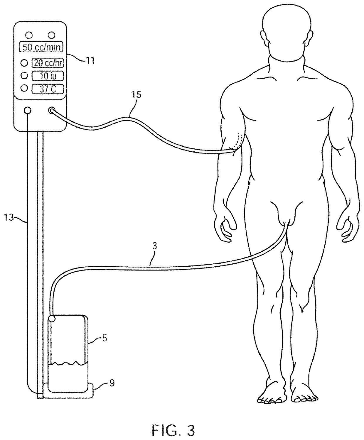 Systems, devices and methods for draining and analyzing bodily fluids