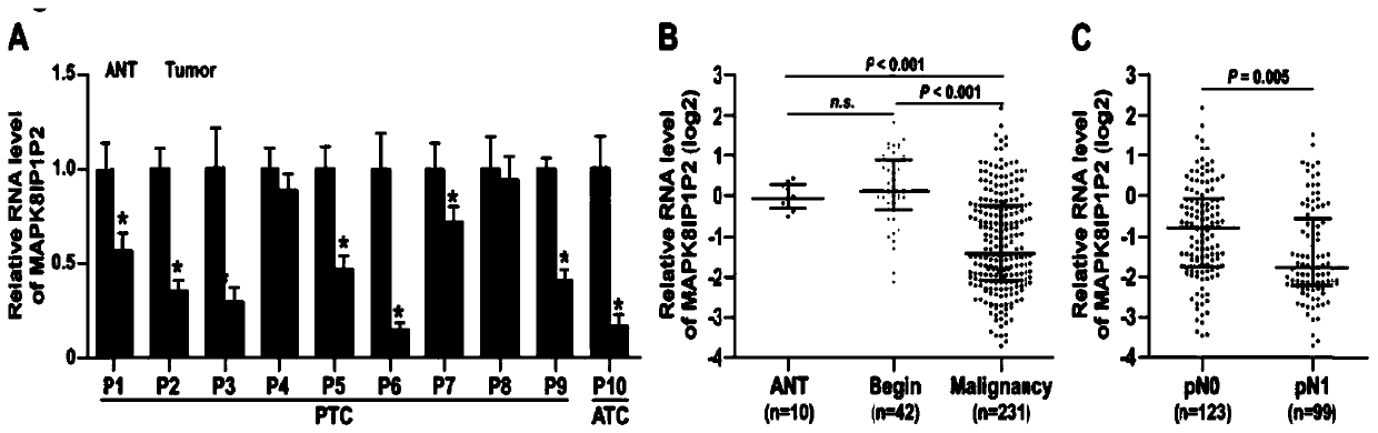 Thyroid cancer diagnosis prognostic marker MAPK8IP1P2 and application thereof