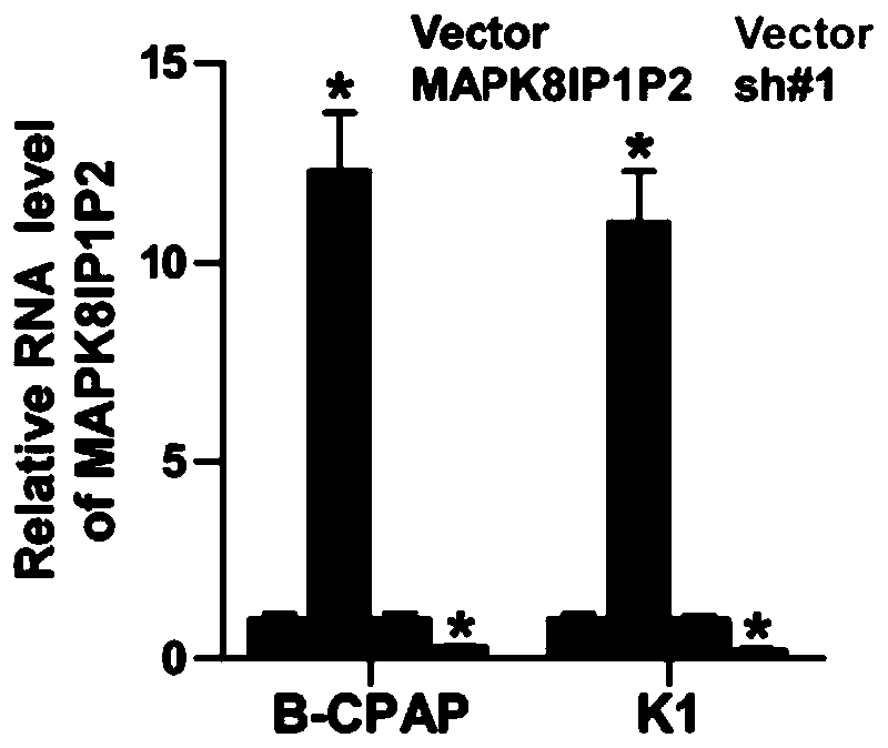 Thyroid cancer diagnosis prognostic marker MAPK8IP1P2 and application thereof