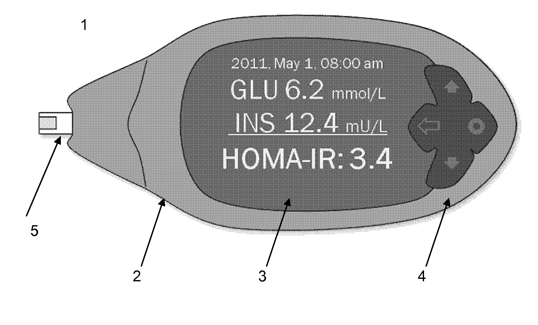 Assay and method for determining insulin-resistance