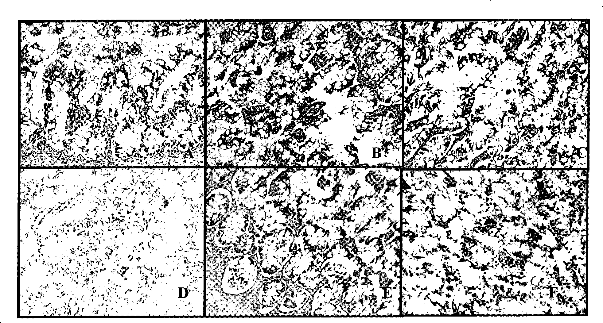 Method for separating, purifying, culturing and proliferating totipotent stem cell from tissue of early aborted fetus of human being