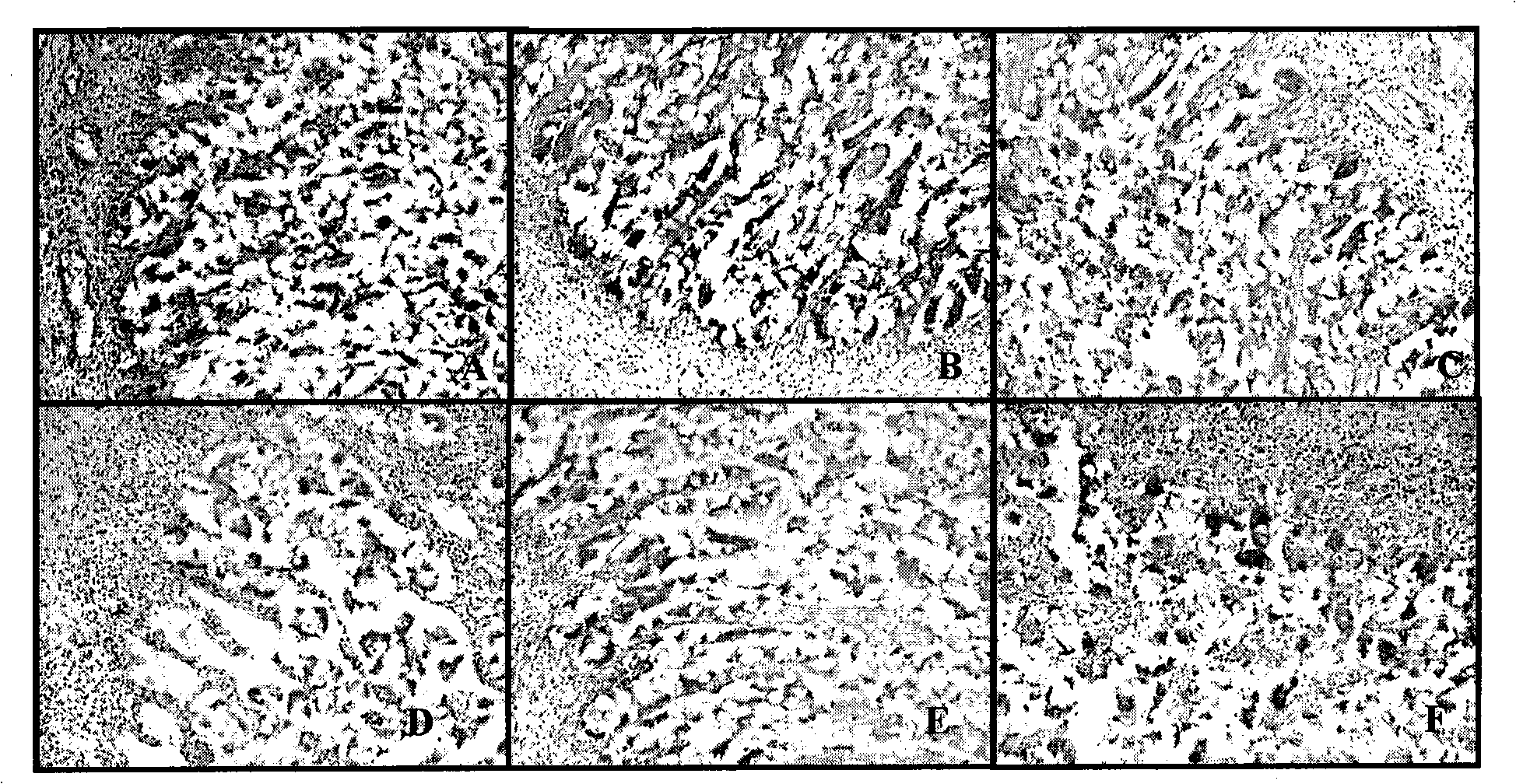 Method for separating, purifying, culturing and proliferating totipotent stem cell from tissue of early aborted fetus of human being