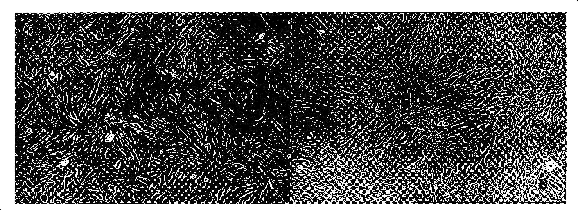 Method for separating, purifying, culturing and proliferating totipotent stem cell from tissue of early aborted fetus of human being