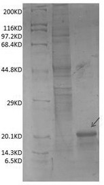 CHI3L1 monoclonal antibody as well as preparation method and application thereof