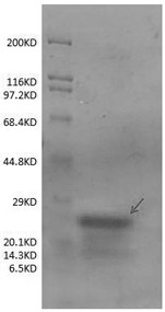 CHI3L1 monoclonal antibody as well as preparation method and application thereof