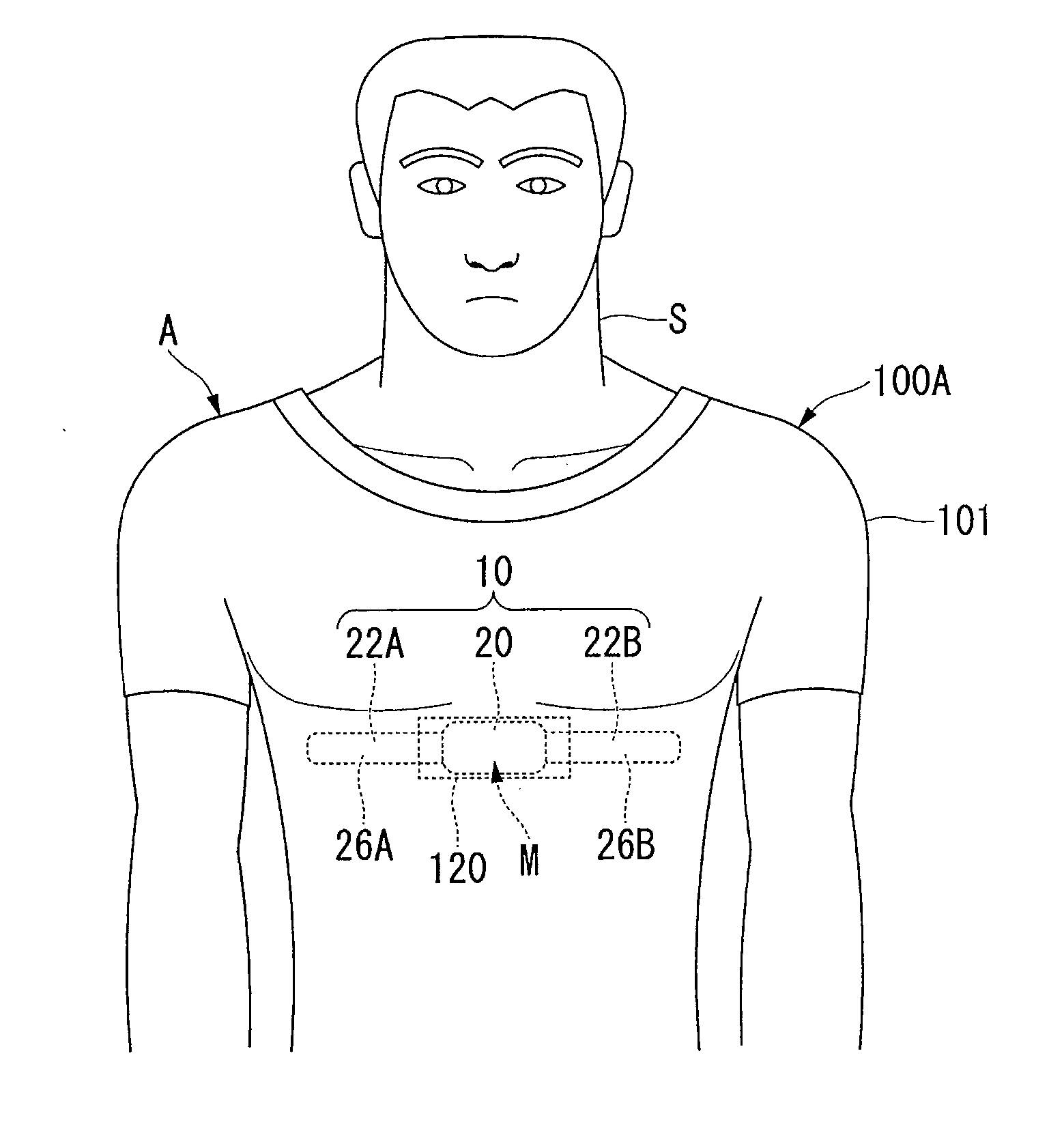 Garment