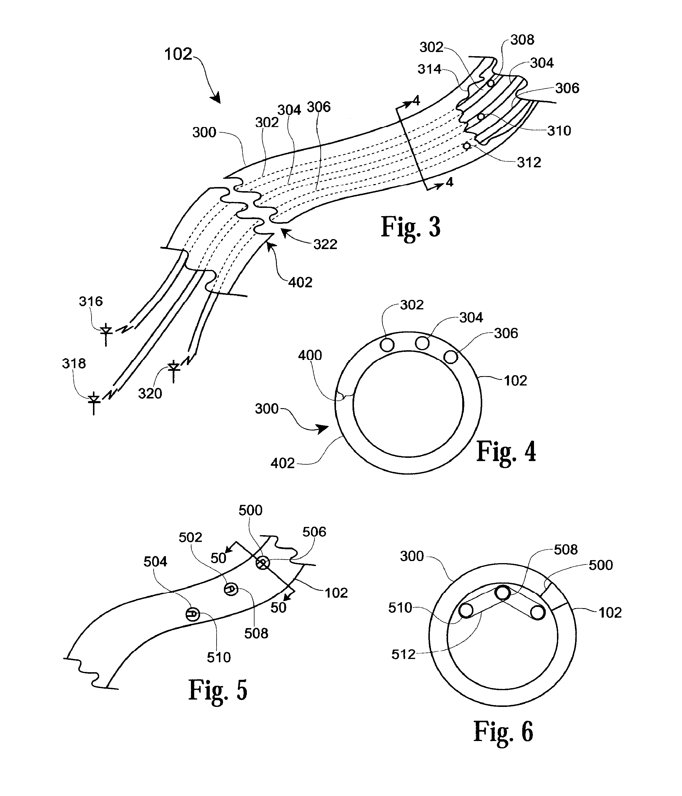 Determining Inserted Catheter End Location and Orientation