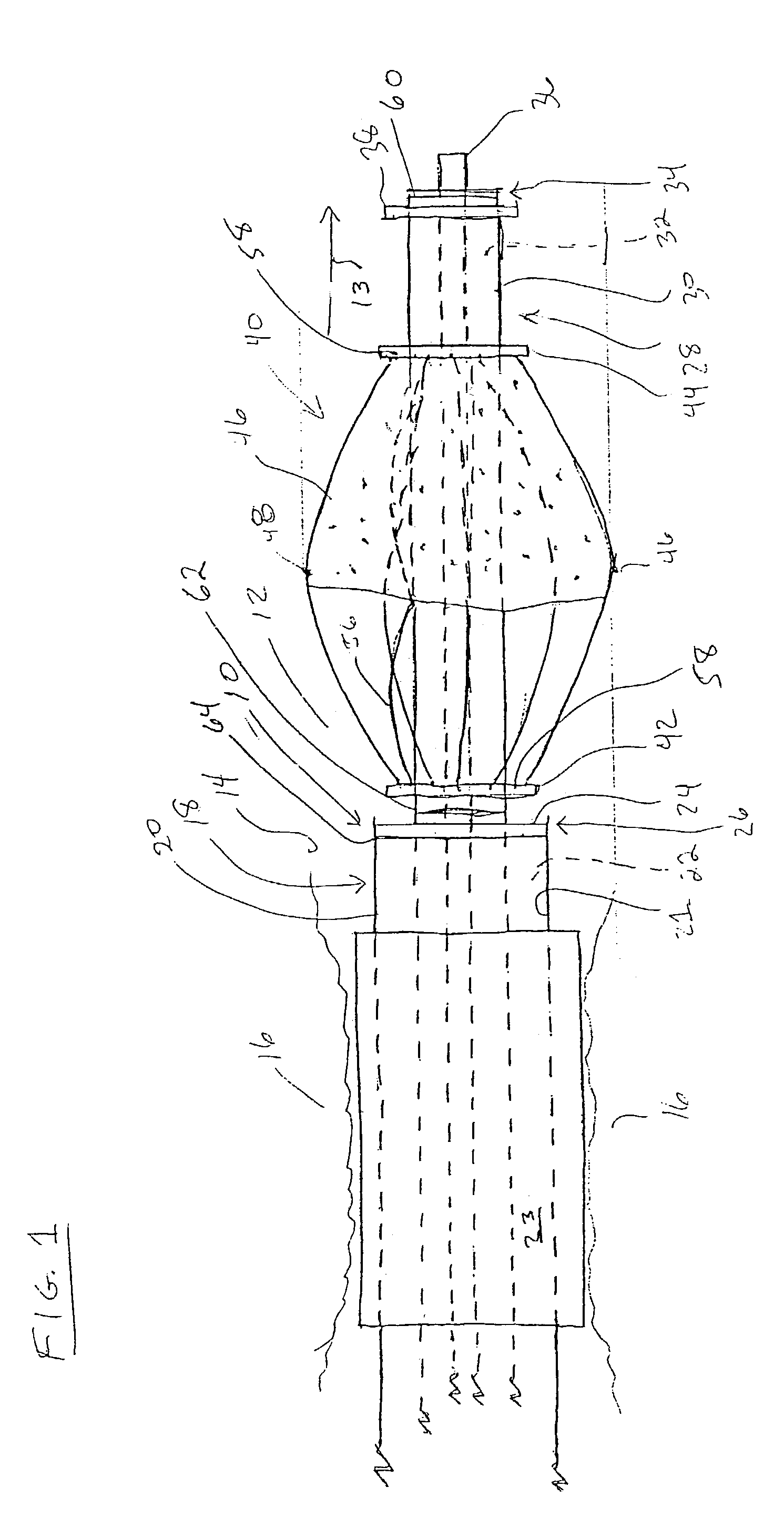 Apparatus for trapping emboli