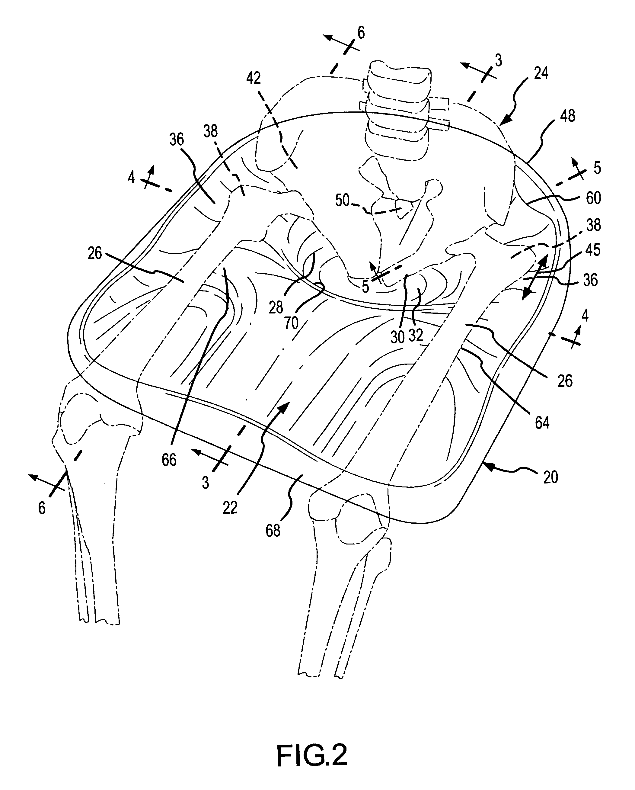 Contoured seat cushion and method for offloading pressure from skeletal bone prominences and encouraging proper postural alignment