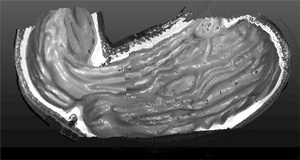 A three-dimensional reconstruction method of endoscopic images combining sfm and binocular matching