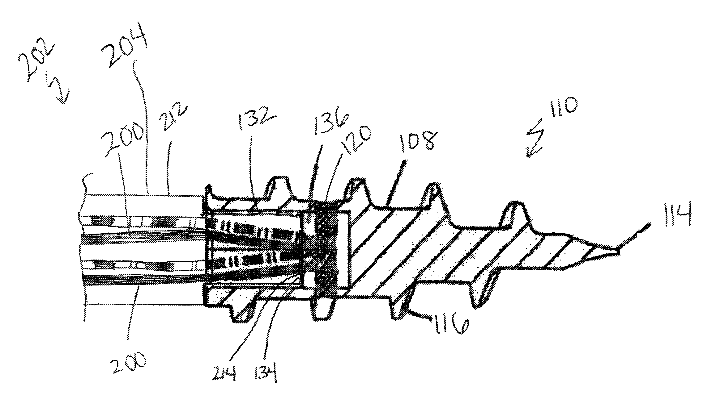 Fully threaded suture anchor with transverse anchor pin