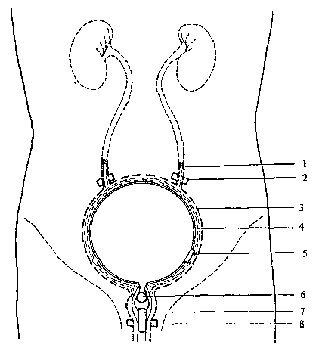 Intelligent in-situ implanted artificial bladder