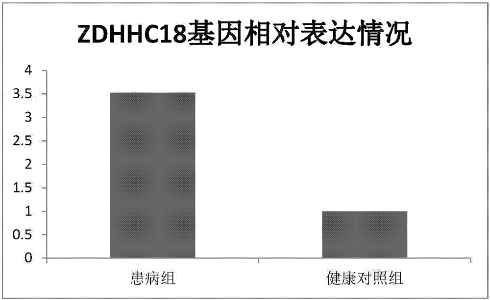 Application of miR-1912 and target gene thereof in diagnosis and treatment of myocardial infarction