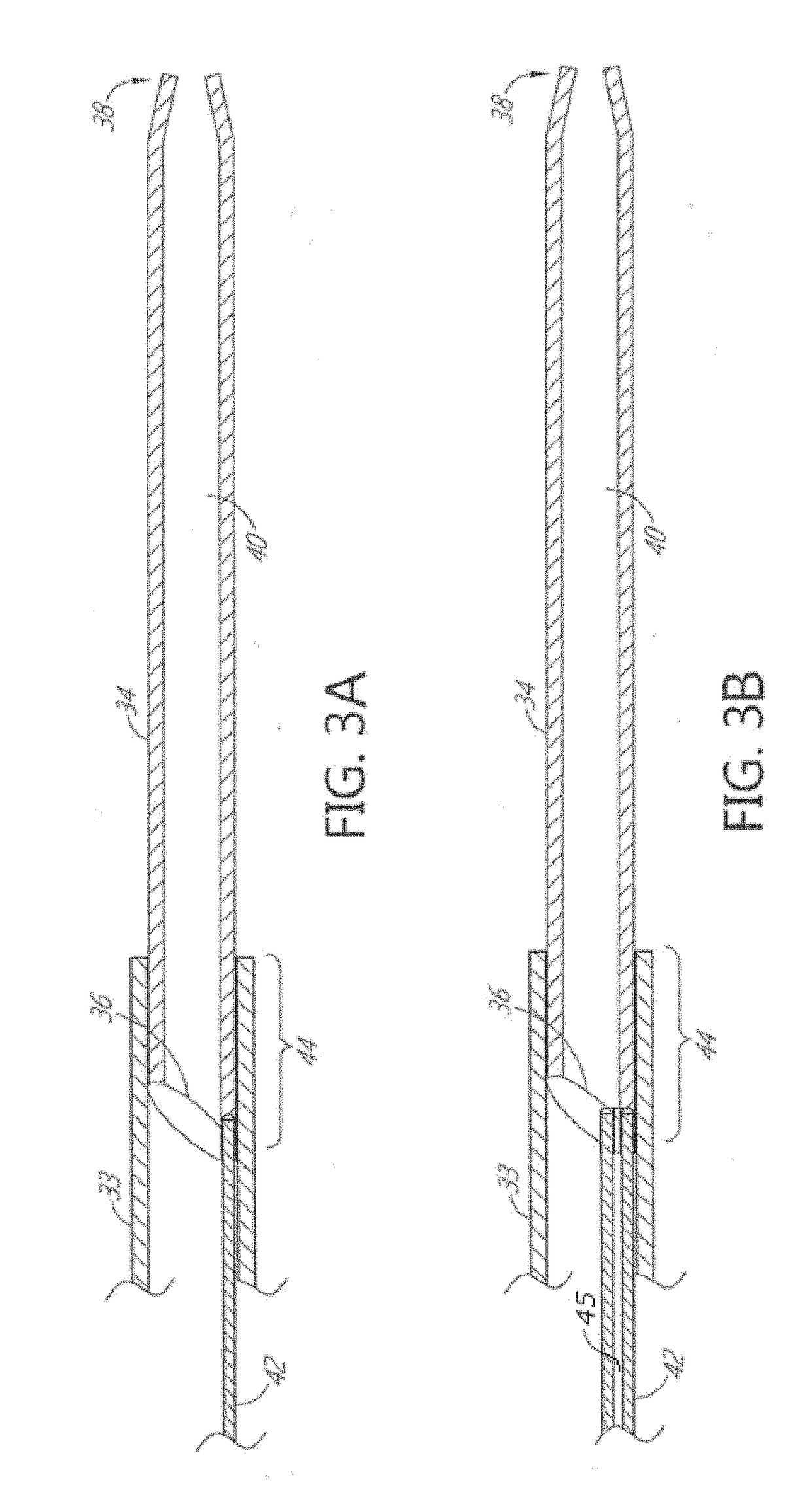 Enhanced flexibility neurovascular catheter