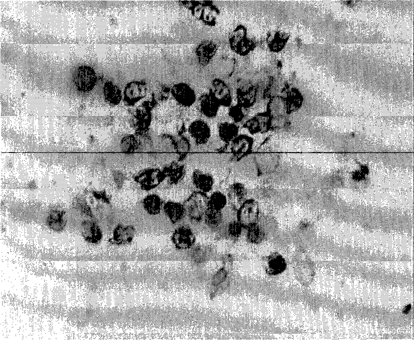 In situ hybridization detection kit for lung cancer , detecting method and use thereof