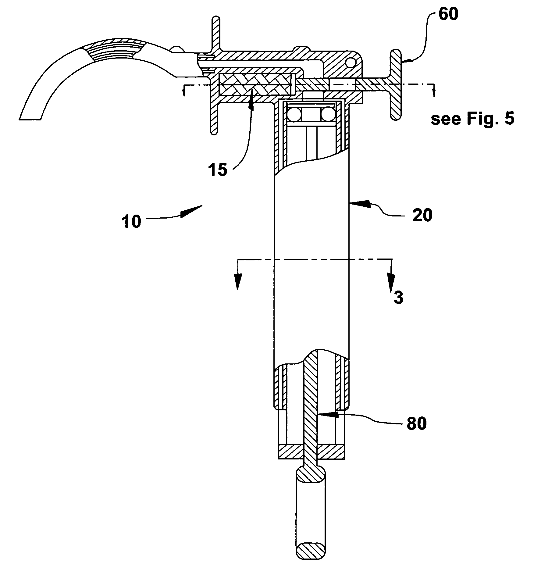 Device for removing a lodged mass