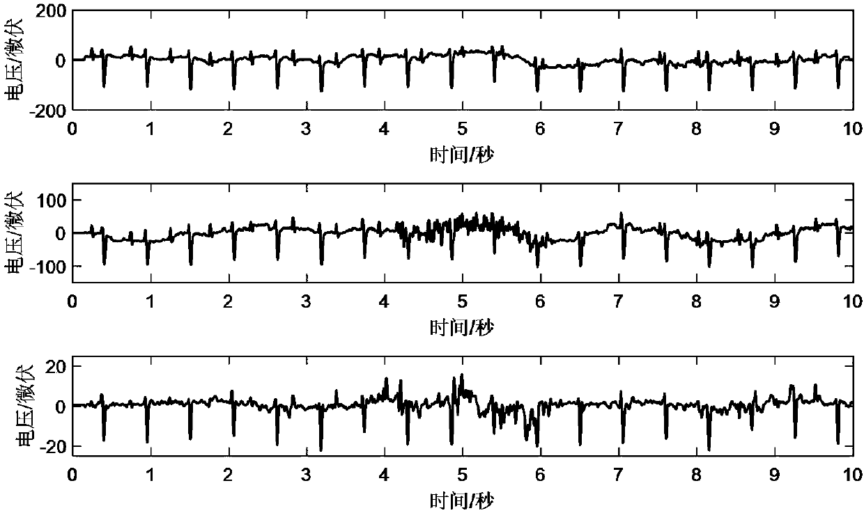 System for monitoring heart rate of fetus in mother body