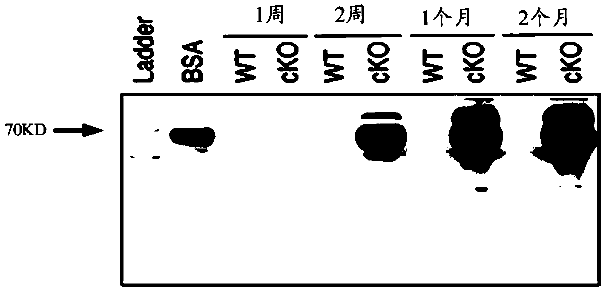 Application of kindlin-2 protein as a target in the preparation of drugs for treating nephritis