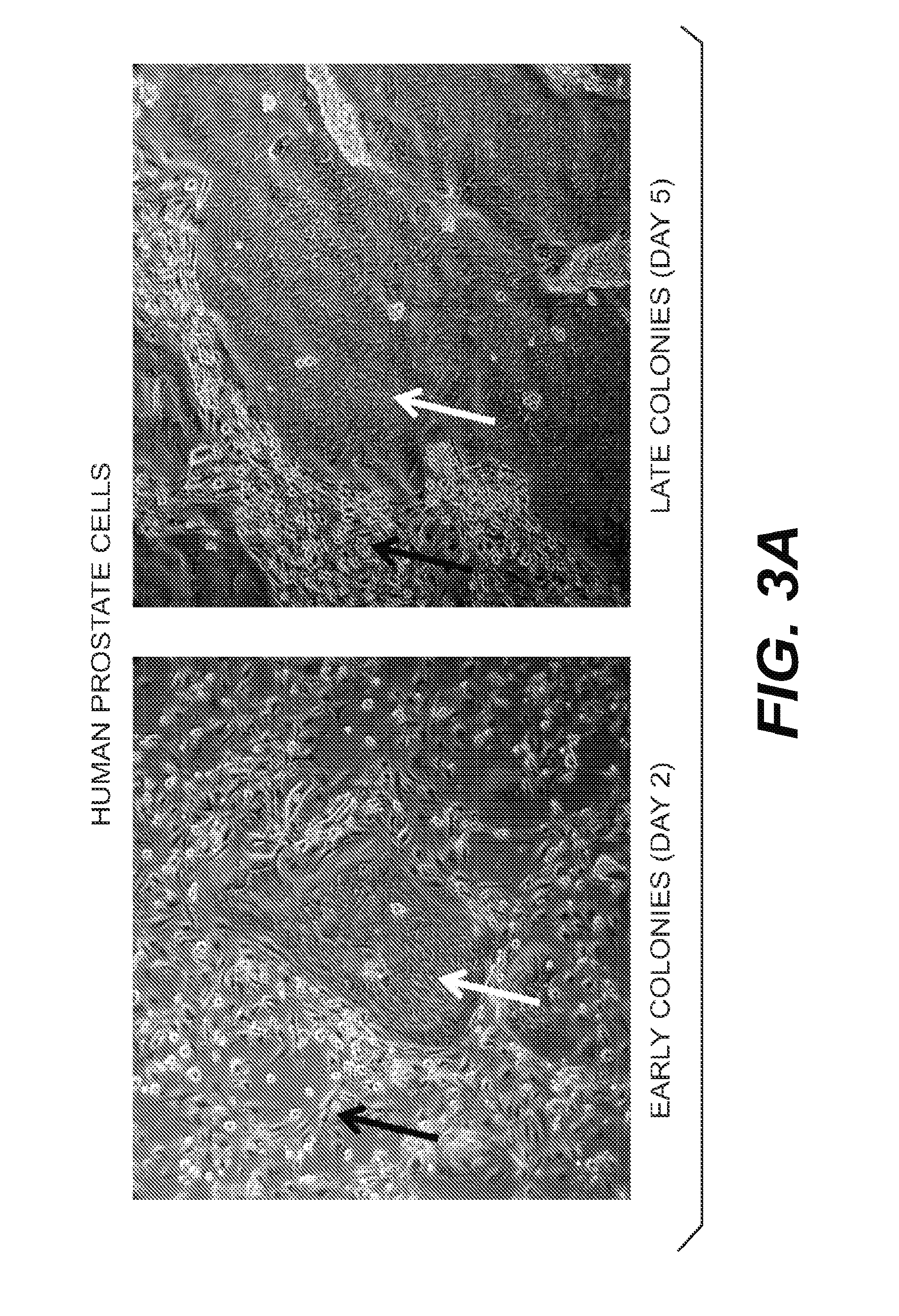 Immortalization of Epithelial Cells and Methods of Use