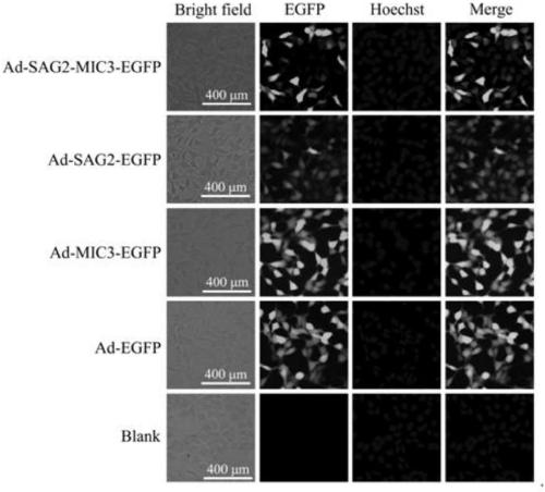 Construction method of toxoplasma gondii SAG2 gene and MIC3 gene recombinant adenovirus, recombinant adenovirus and application