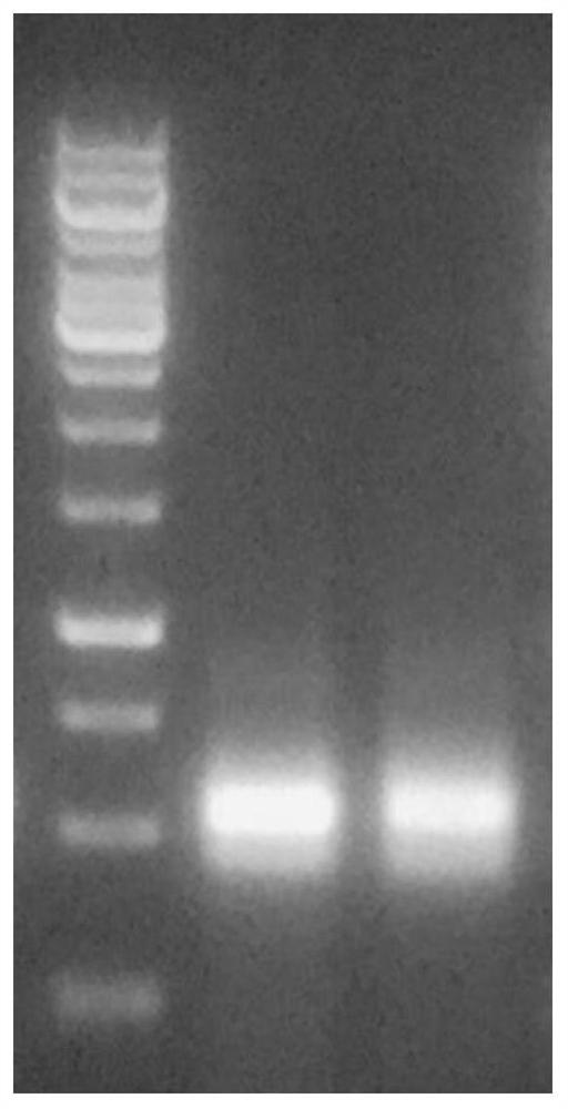 A kind of anti-human neurofilament light chain (nefl) monoclonal antibody and its application