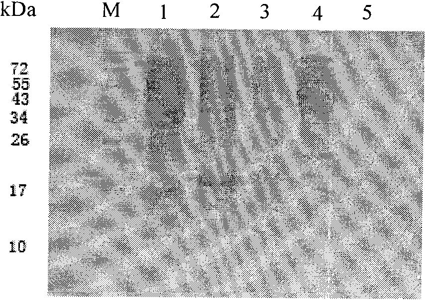 Preparation method and application of Qbeta-2aa phage virus-like particle protein