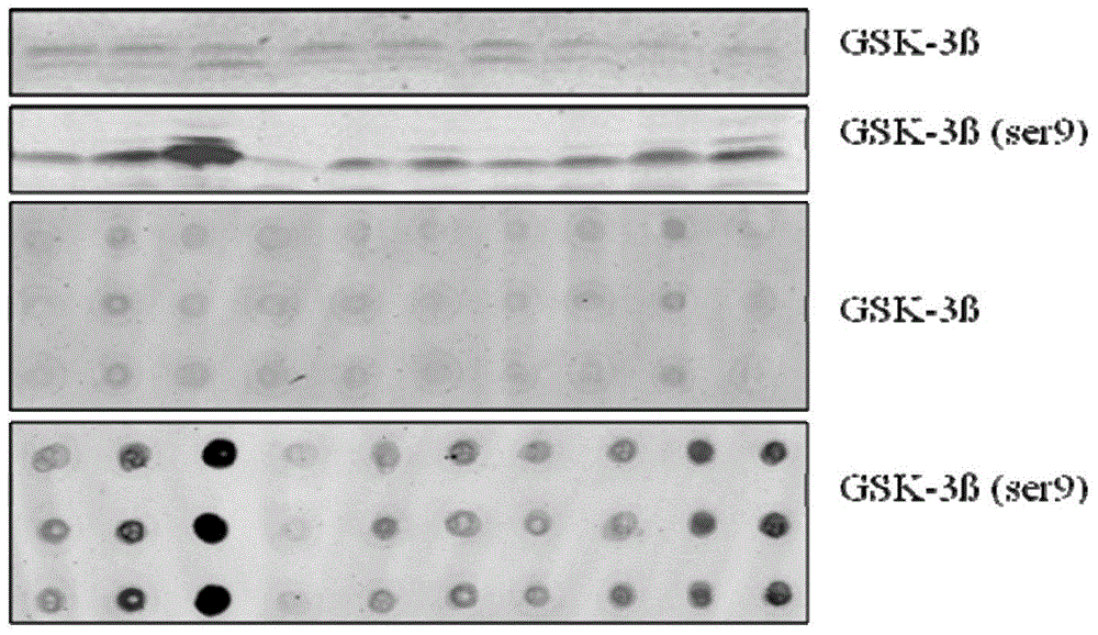 Dot blotting method for detecting activity of GSK-3beta proteins of human blood platelets