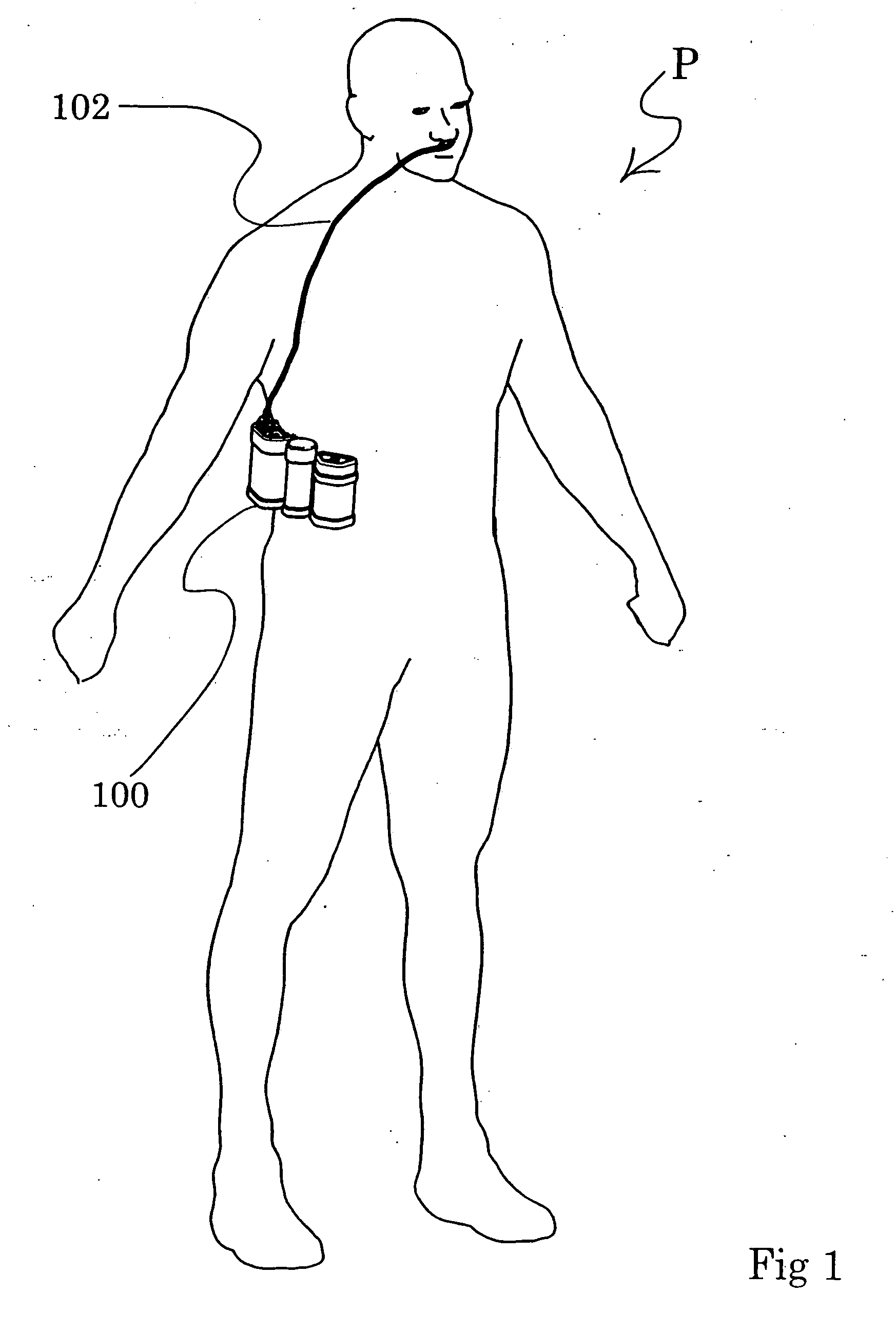 Personal oxygen concentrator