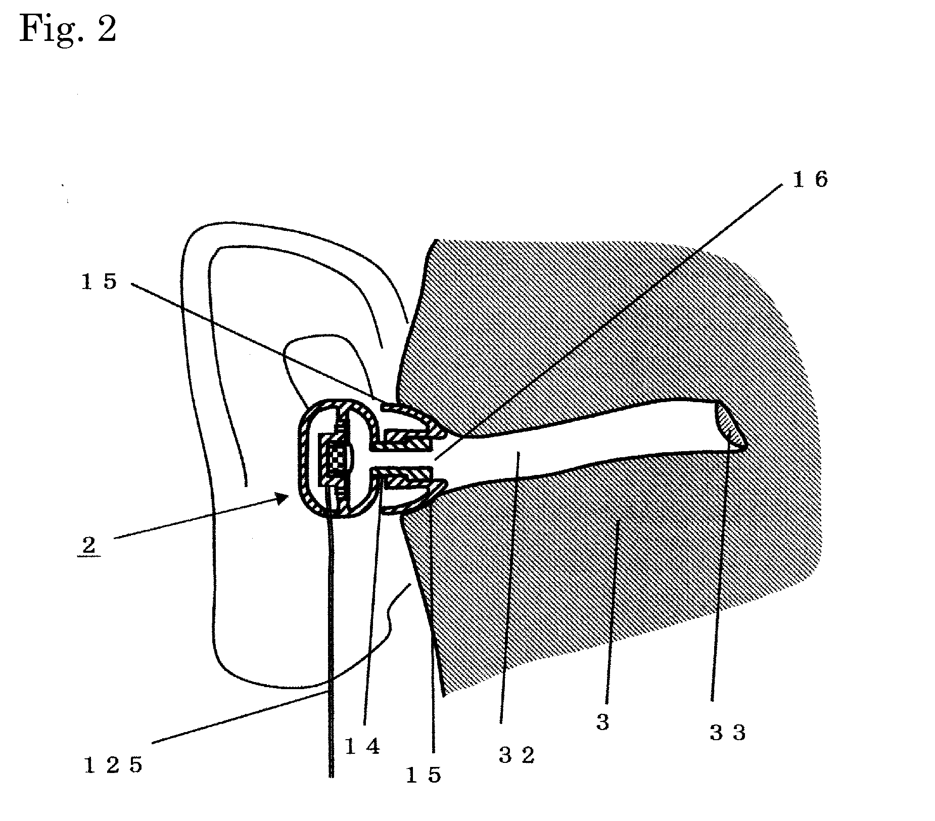 Twin driver earphone