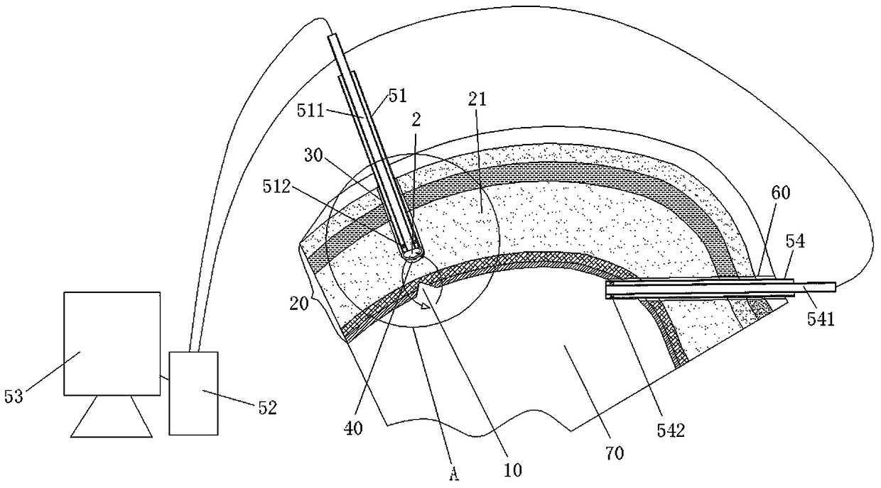 Subcutaneous space builder and using method thereof