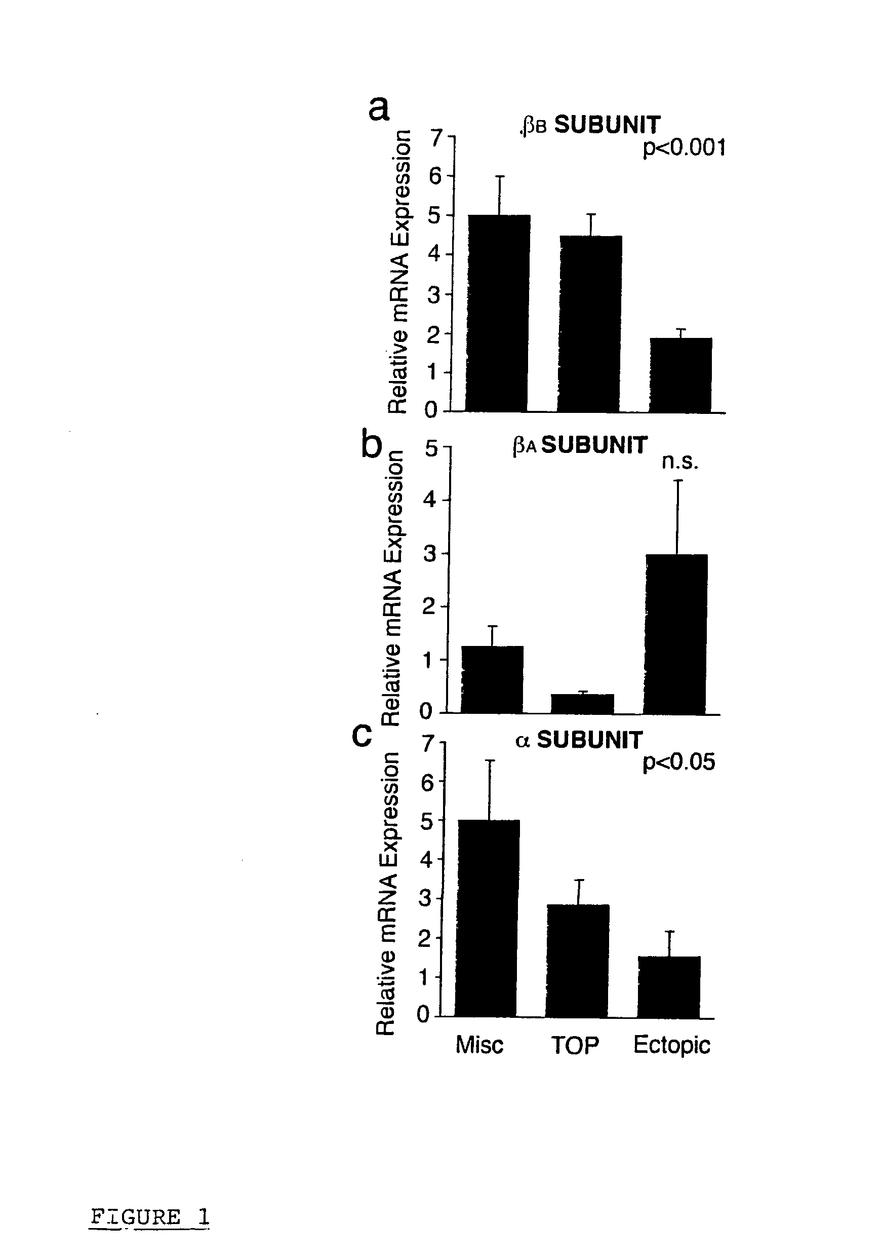 Identification of ectopic pregnancies