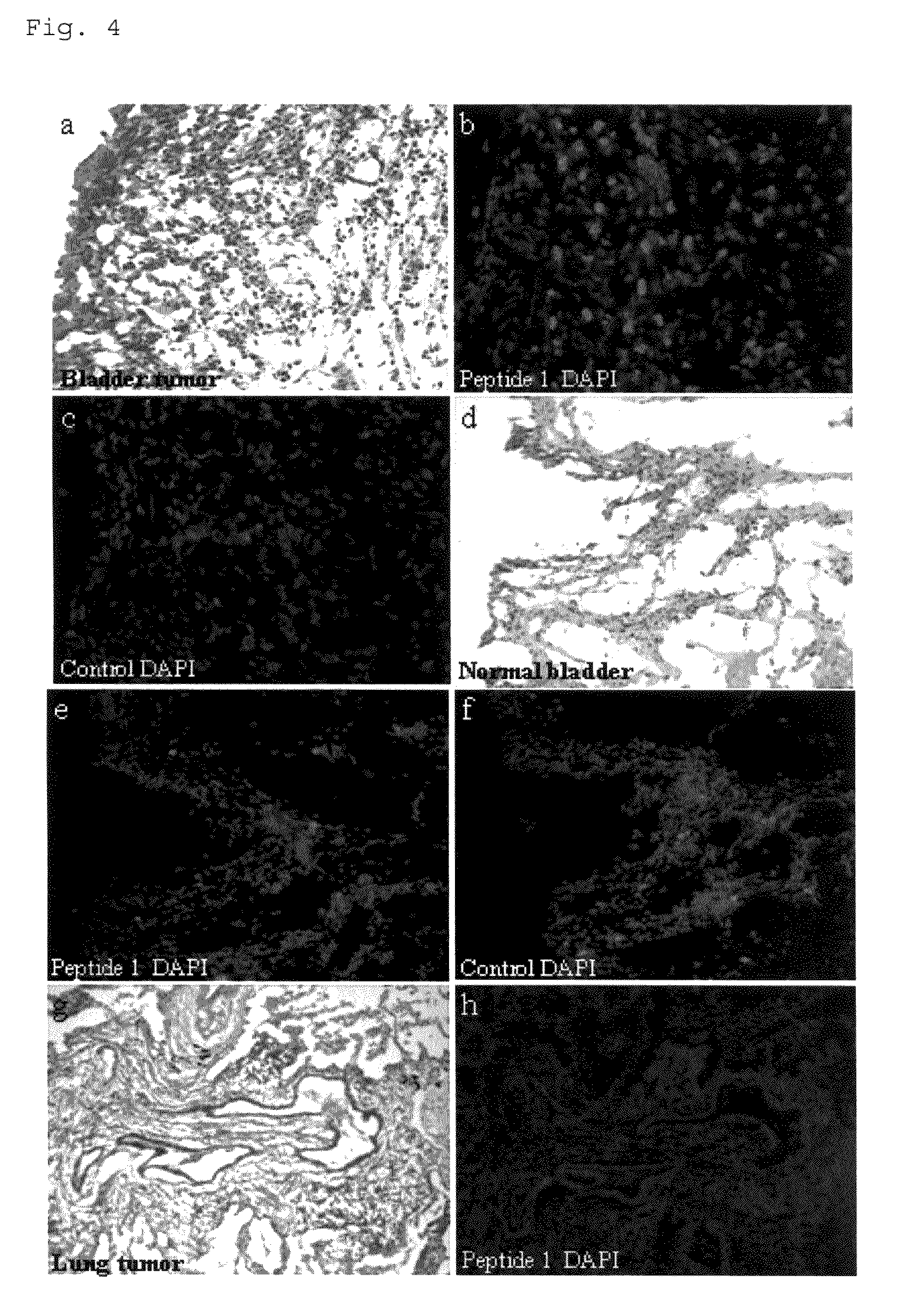 Bladder tumor-targeting peptide and use thereof