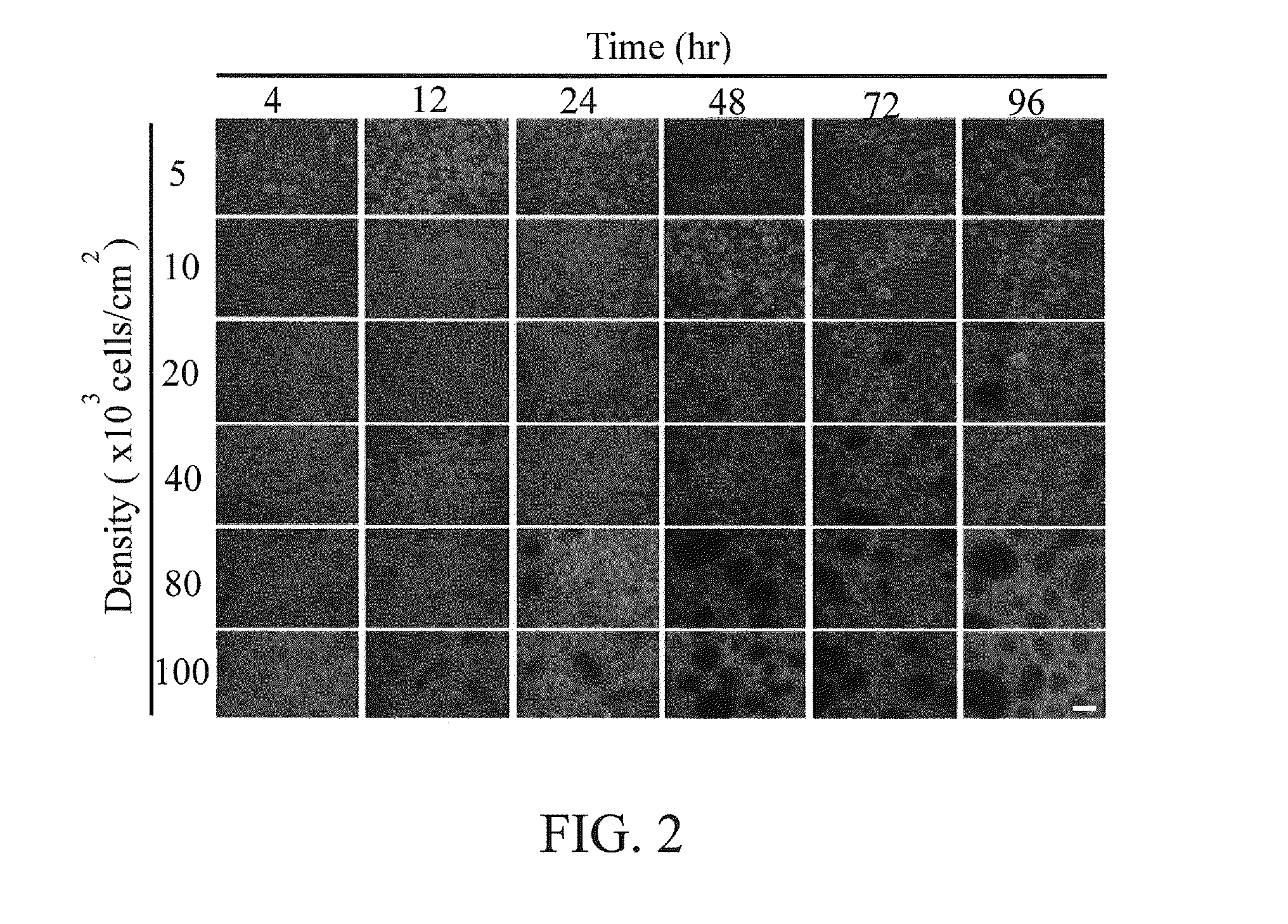 Method for inducing spheroid formation of adipose-derived stem cells and trans-differentiation into neural lineage