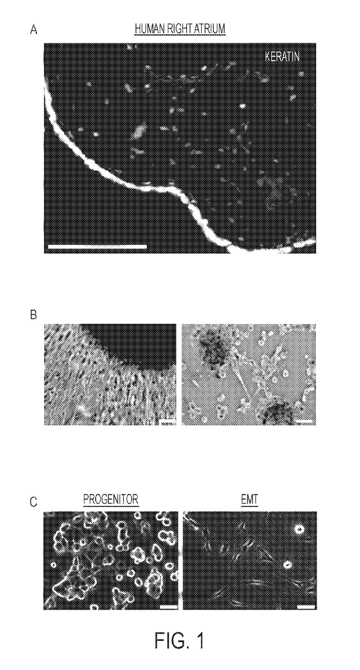 Compositions and methods for vascular protection against reperfusion injury after myocardial ischemia