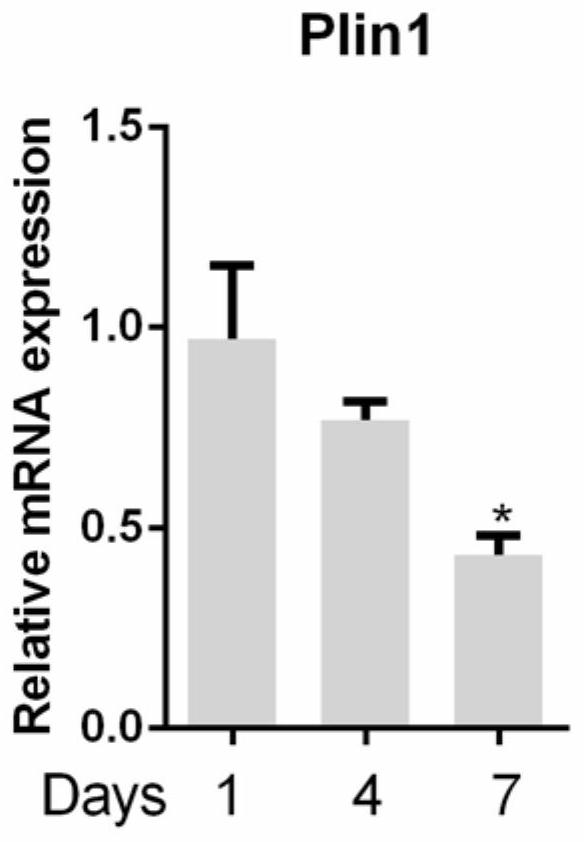 Application of perilipin1 expression intervention agent in the preparation of anti-hepatic fibrosis drugs