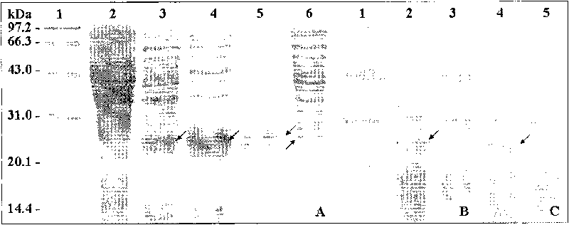 Human oocyte zona pellucida protein multi-epitope chimeric peptide antigen and preparation method thereof