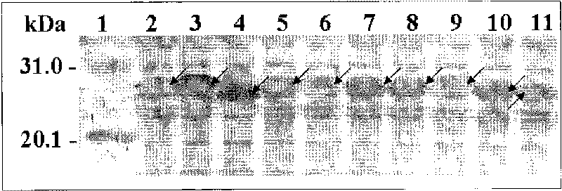 Human oocyte zona pellucida protein multi-epitope chimeric peptide antigen and preparation method thereof