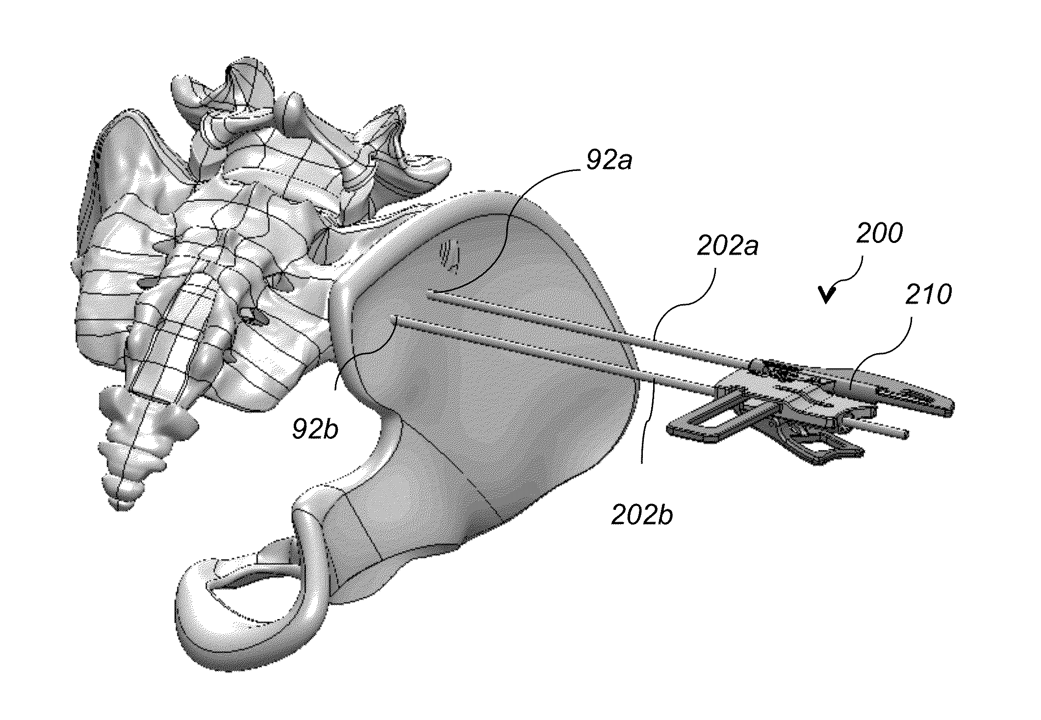 System AMD method for bone fusing implants and implant insertion tools