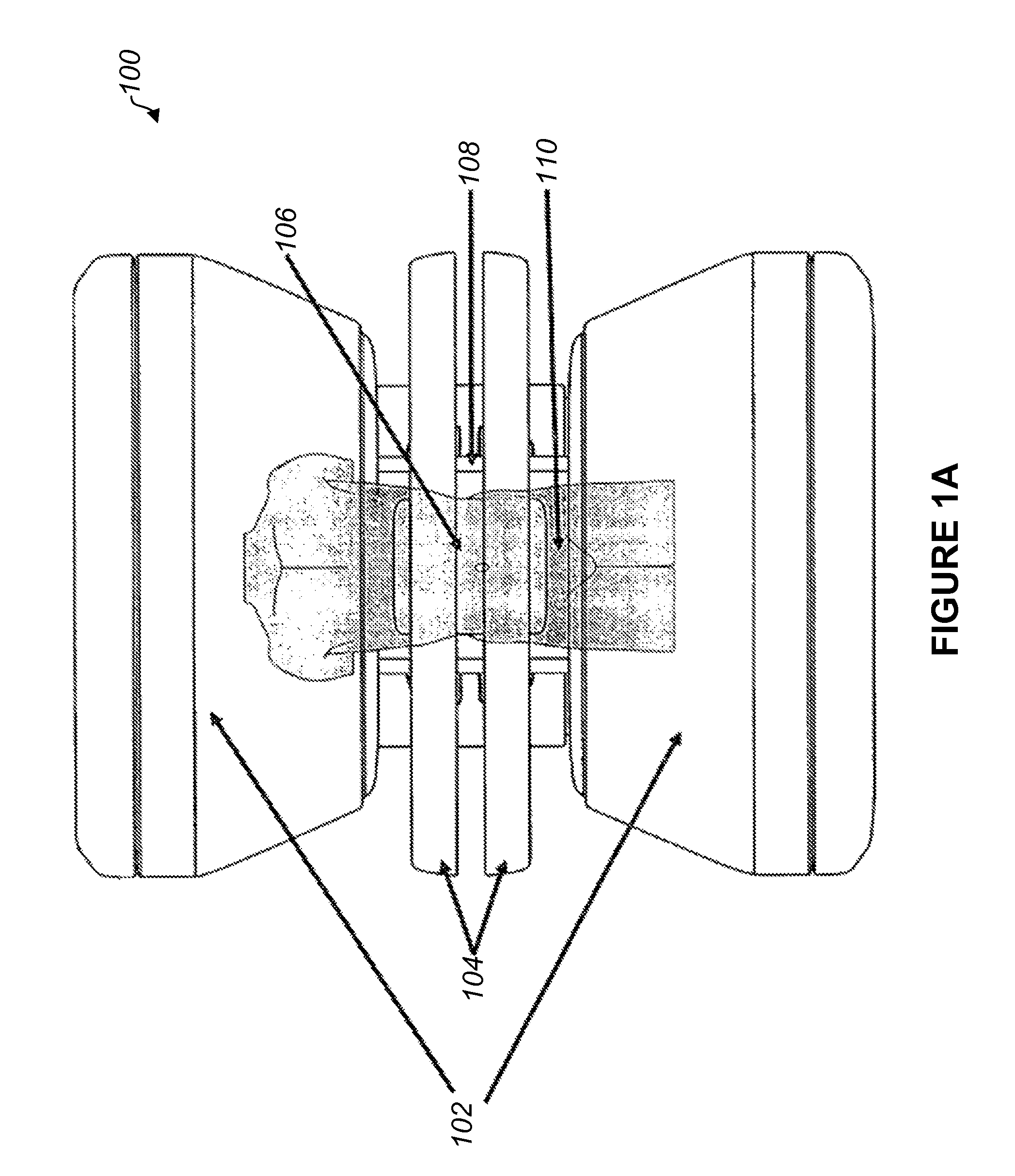 Method and apparatus for shielding a linear accelerator and a magnetic resonance imaging device from each other