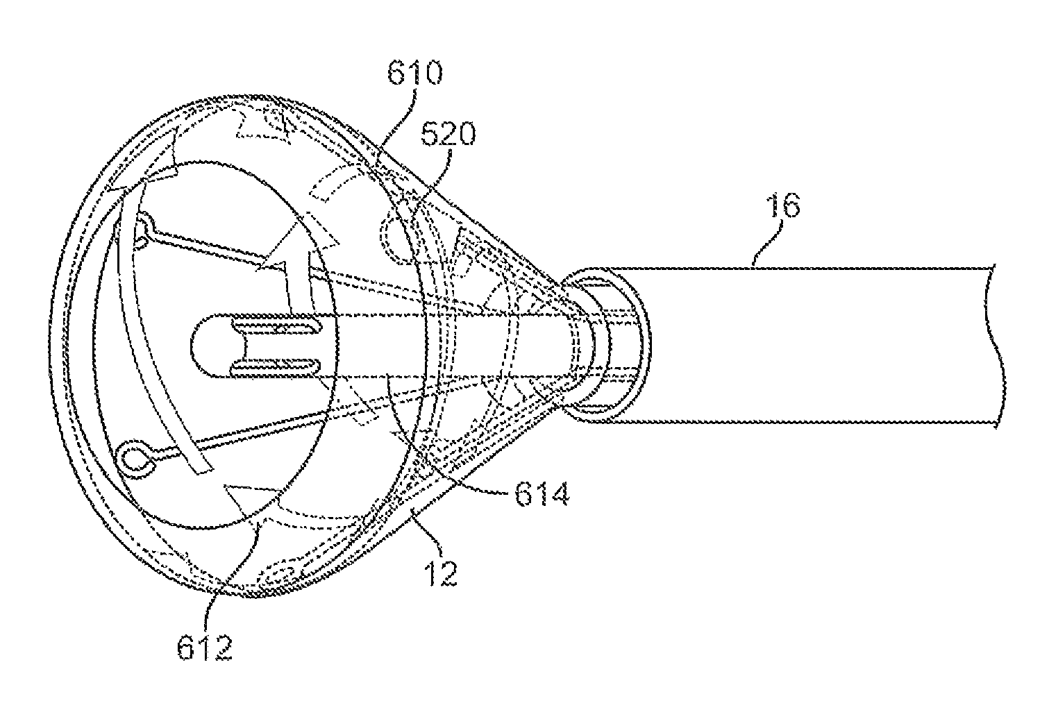 Tissue visualization device and method variations